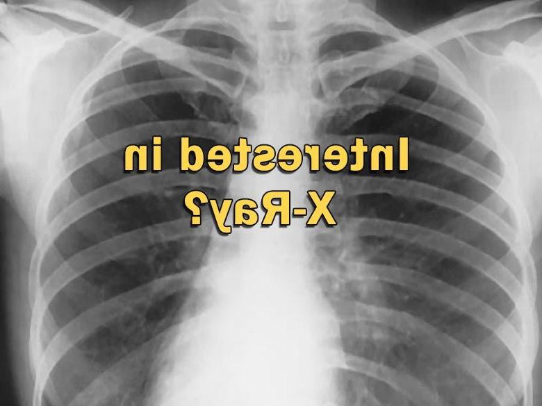 The text "Interested in X-ray?" over a chest x-ray